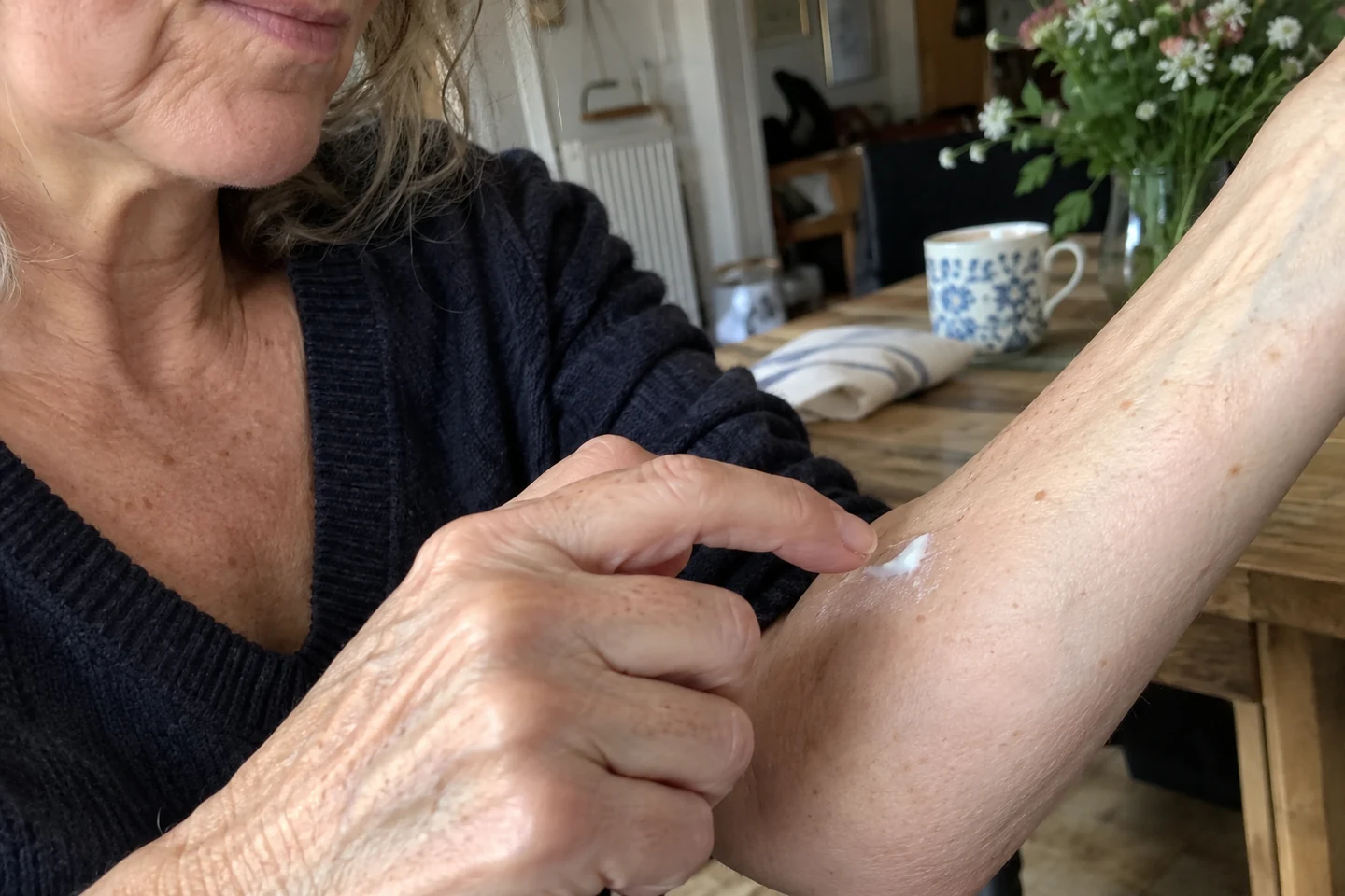 Essai local d’une petite quantité de crème sur l’avant-bras